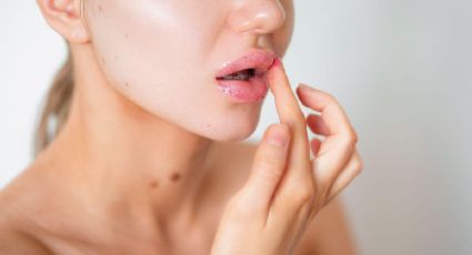 Estos tips de cuidado son los más efectivos para los labios quemados: descubre por qué