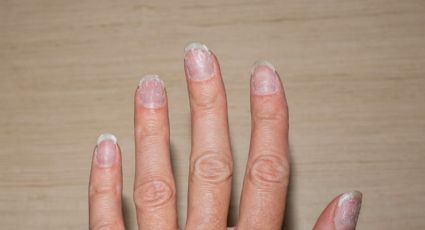 Cómo prevenir las uñas quebradizas: 5 consejos para fortalecer tus uñas