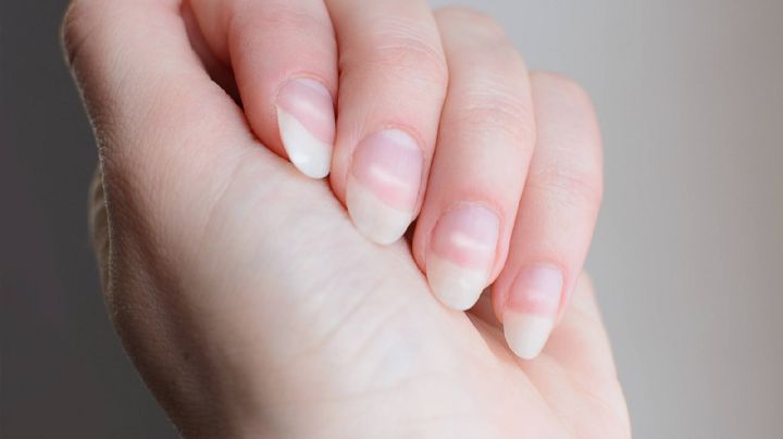 La razón por la que se producen las manchas blancas en las uñas y cómo combatirlas