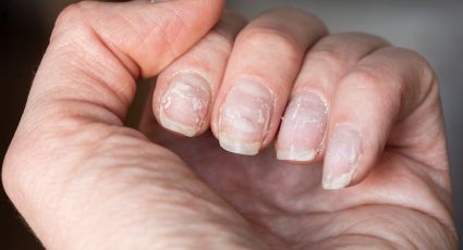 Cómo evitar las uñas escamadas: 5 consejos para que tus uñas crezcan fuertes y sanas