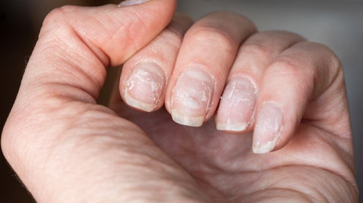 Cómo evitar las uñas escamadas: 5 consejos para que tus uñas crezcan fuertes y sanas